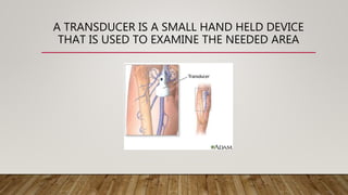 A TRANSDUCER IS A SMALL HAND HELD DEVICE
THAT IS USED TO EXAMINE THE NEEDED AREA
 