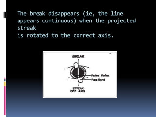 The break disappears (ie, the line
appears continuous) when the projected
streak
is rotated to the correct axis.
 