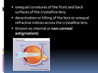  unequal curvatures of the front and back
surfaces of the crystalline lens,
 decentration or tilting of the lens or unequal
refractive indices across the crystalline lens
 (known as internal or non-corneal
astigmatism)
 