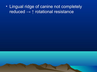 • Lingual ridge of canine not completely
reduced → ↑ rotational resistance
 