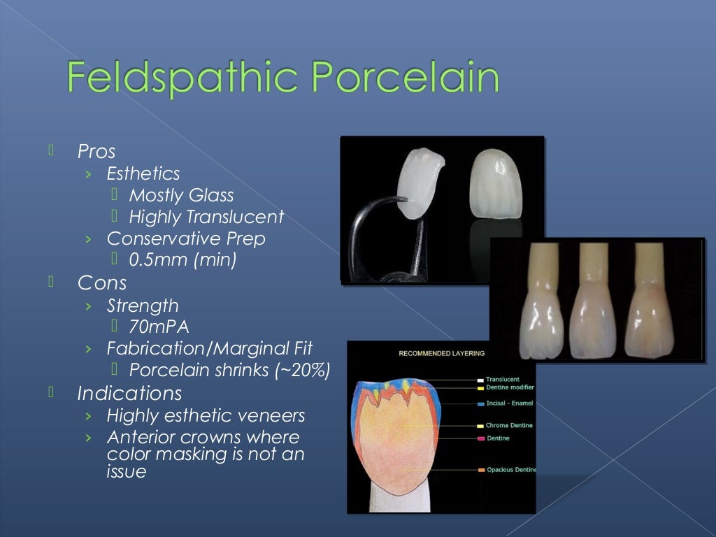All Ceramic Restorations