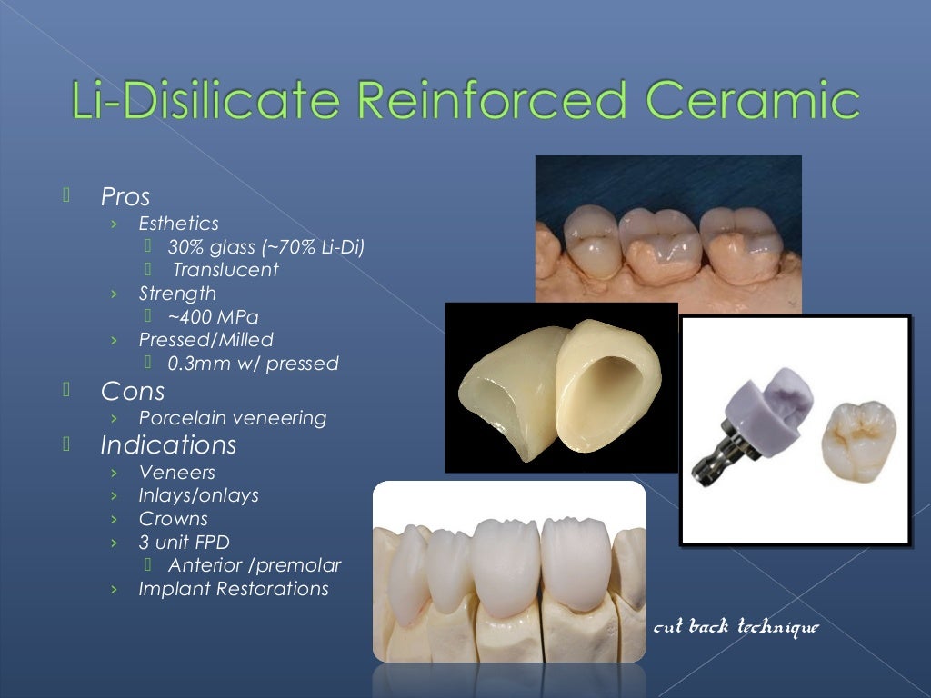 All Ceramic Restorations