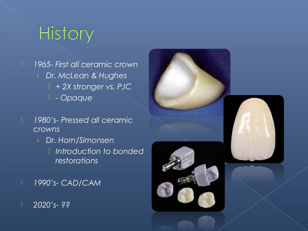 All Ceramic Restorations