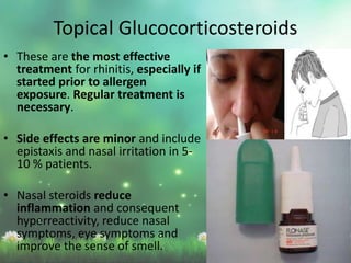 • These are the most effective
treatment for rhinitis, especially if
started prior to allergen
exposure. Regular treatment is
necessary.
• Side effects are minor and include
epistaxis and nasal irritation in 5-
10 % patients.
• Nasal steroids reduce
inflammation and consequent
hyperreactivity, reduce nasal
symptoms, eye symptoms and
improve the sense of smell.
Topical Glucocorticosteroids
 