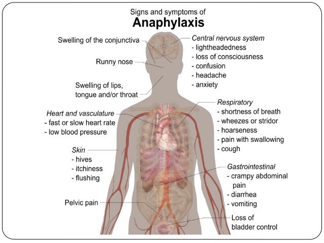 Allergic Disorders In Children