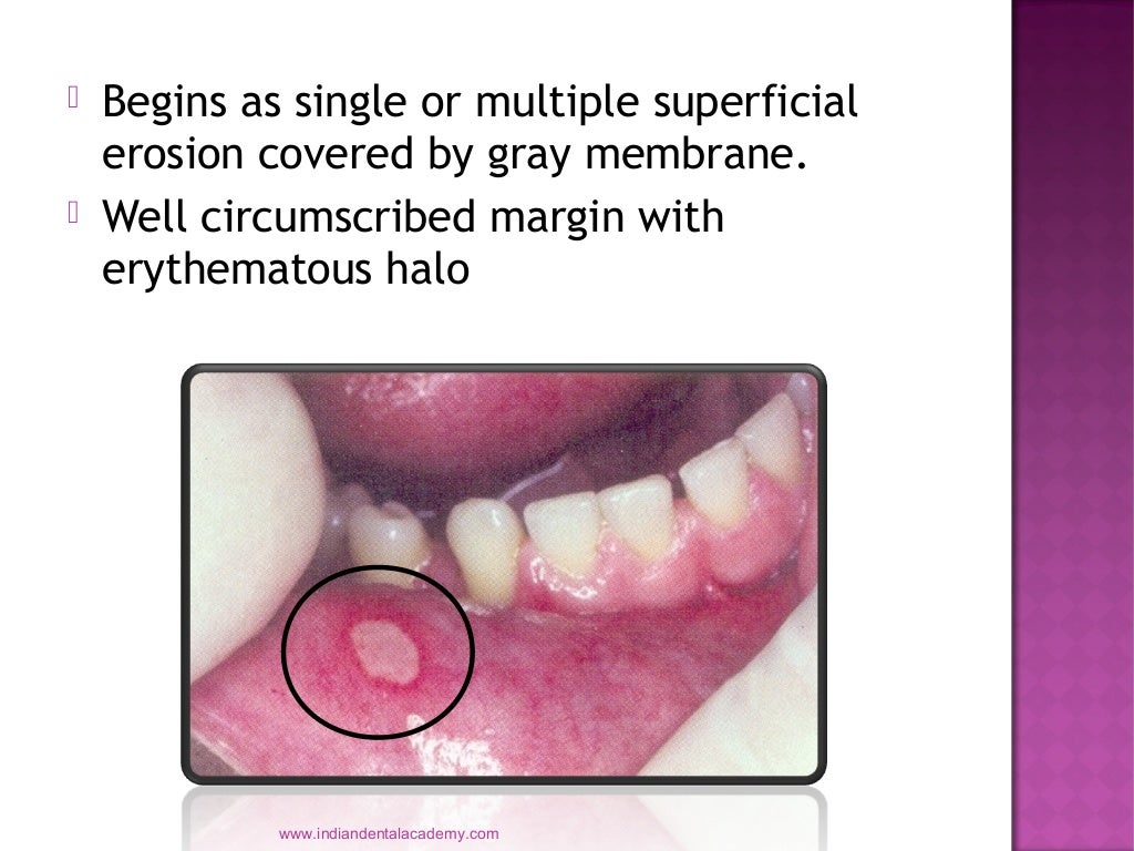 Allergic and immunologic diseases / dental implant courses by Indian…
