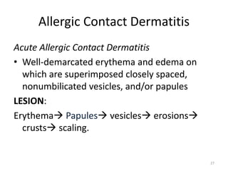 Allergic Contact Dermatitis
Acute Allergic Contact Dermatitis
• Well-demarcated erythema and edema on
which are superimposed closely spaced,
nonumbilicated vesicles, and/or papules
LESION:
Erythema Papules vesicles erosions
crusts scaling.

27

 