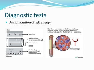Diagnostic tests 
 Demonstration of IgE allergy 
 