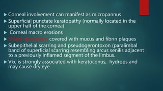  Corneal involvement can manifest as micropannus
 Superficial punctate keratopathy (normally located in the
upper half of the cornea)
 Corneal macro erosions
 Shield ulcerations covered with mucus and fibrin plaques
 Subepithelial scarring and pseudogerontoxon (paralimbal
band of superficial scarring resembling arcus senilis adjacent
to a previously inflamed segment of the limbus.
 Vkc is strongly associated with keratoconus, hydrops and
may cause dry eye.
 