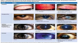 Allergic Conjunctivitis - Dr Arnav Saroya