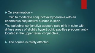  On examination –
mild to moderate conjunctival hyperemia with an
edematous conjunctival surface is seen.
The palpebral conjunctiva appears pale pink in color with
diffuse areas of slightly hypertrophic papillae predominantly
located in the upper tarsal conjunctiva .
 The cornea is rarely affected.
 