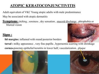ATOPIC KERATOCONJUNCTIVITIS
Adult equivalent of VKC Young atopic adults with male predominance
May be associated with atopic dermatitis
Symptoms ;itching , soreness , dry sensation , mucoid discharge , phtophobia or
blurred vision
Signs :
lid margins: inflamed with round posterior borders
tarsal : milky appearance , very fine papilla , hyperaemia scarring with shrinkage
cornea-punctate epithelial keratitis in lower half, vascularization , plaque
 
