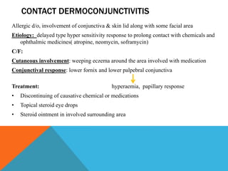 CONTACT DERMOCONJUNCTIVITIS
Allergic d/o, involvement of conjunctiva & skin lid along with some facial area
Etiology: delayed type hyper sensitivity response to prolong contact with chemicals and
ophthalmic medicines( atropine, neomycin, soframycin)
C/F:
Cutaneous involvement: weeping eczema around the area involved with medication
Conjunctival response: lower fornix and lower palpebral conjunctiva
Treatment: hyperaemia, papillary response
• Discontinuing of causative chemical or medications
• Topical steroid eye drops
• Steroid ointment in involved surrounding area
 