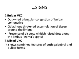 …SIGNS
2.Bulbar VKC
• Dusky red triangular congestion of bulbar
conjunctiva
• Gelatinous thickened accumulation of tissue
around the limbus
• Presence of discrete whitish raised dots along
the limbus (Tranta's spots)
3.Mixed VKC
It shows combined features of both palpebral and
bulbar forms
 