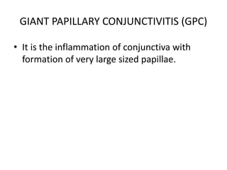 GIANT PAPILLARY CONJUNCTIVITIS (GPC)
• It is the inflammation of conjunctiva with
formation of very large sized papillae.
 