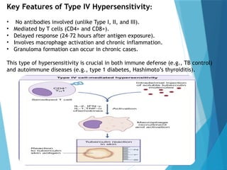 Comprehensive Overview of Allergic and Hypersensitivity Reactions ...