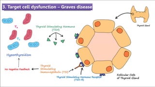 3. Target cell dysfunction – Graves disease
 