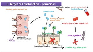 3. Target cell dysfunction – pernicious
anaemia
 