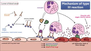 Mechanism of type
III reaction
Lumen of blood vessel
 