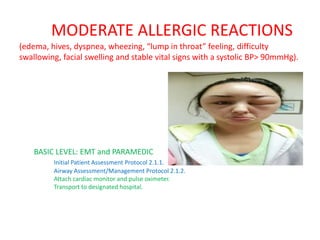 MODERATE ALLERGIC REACTIONS
(edema, hives, dyspnea, wheezing, “lump in throat” feeling, difficulty
swallowing, facial swelling and stable vital signs with a systolic BP> 90mmHg).
BASIC LEVEL: EMT and PARAMEDIC
Initial Patient Assessment Protocol 2.1.1.
Airway Assessment/Management Protocol 2.1.2.
Attach cardiac monitor and pulse oximeter.
Transport to designated hospital.
 