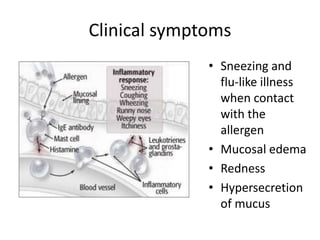 Allergic rhinitis | PPTX