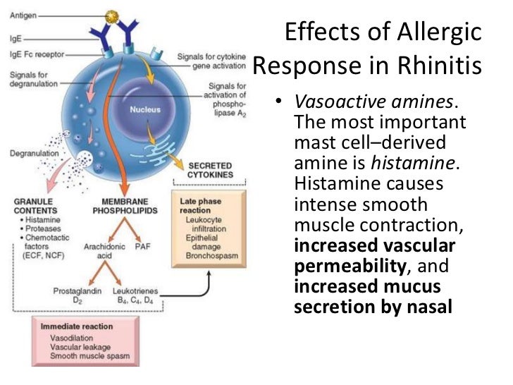 Allergic rhinitis