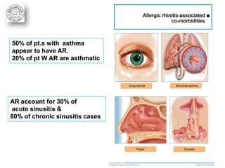50% of pt.s with asthma
appear to have AR.
20% of pt W AR are asthmatic




AR account for 30% of
acute sinusitis &
80% of chronic sinusitis cases
 
