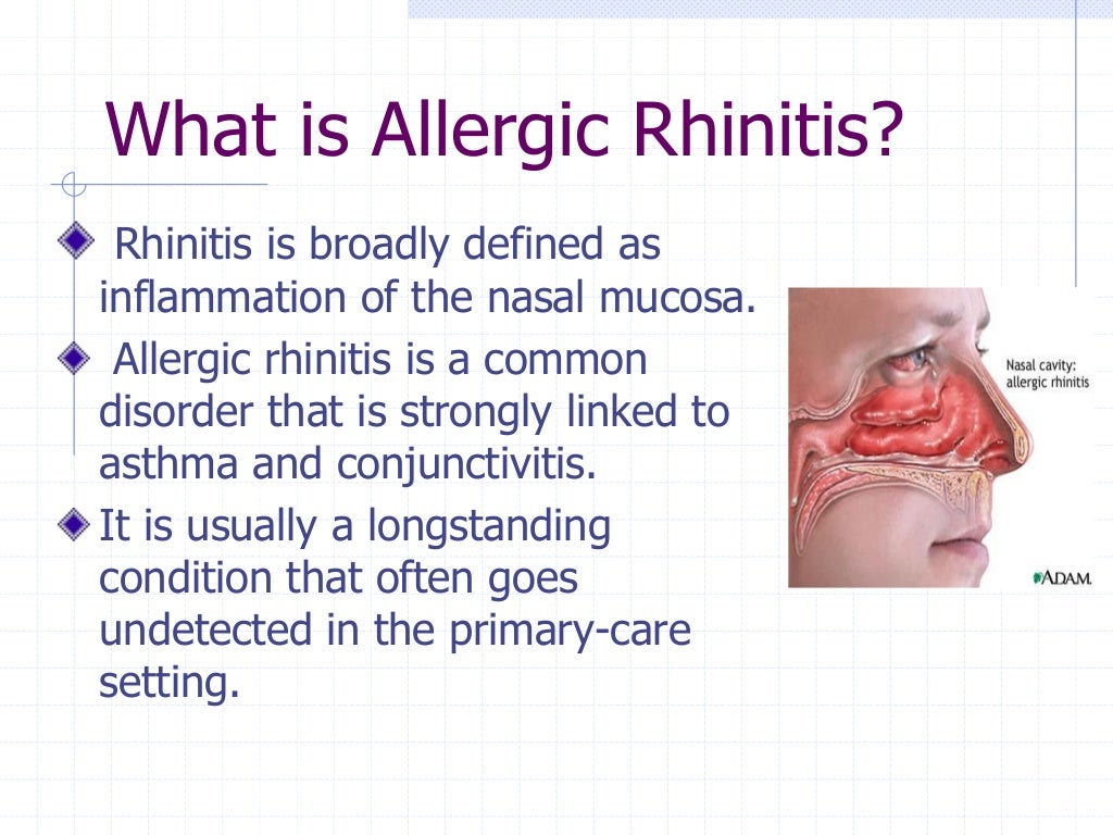 Allergic rhinitis