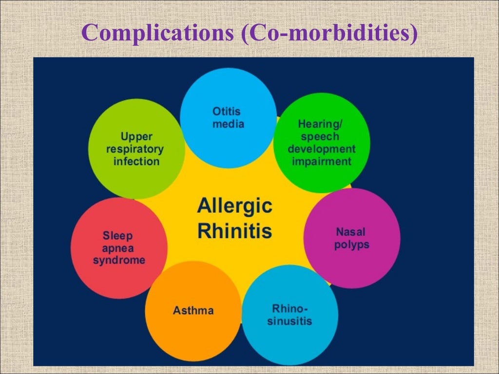 Allergic Rhinitis