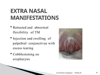 Palbebral Injection allergicrhinitis-150814131204-lva1-app6892-converted-1 (1).pptx