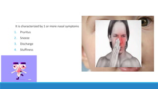It is characterized by 1 or more nasal symptoms
1. Pruritus
2. Sneeze
3. Discharge
4. Stuffiness
 