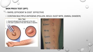 SKIN PRICK TEST (SPT)
• RAPID, EFFICIENT & COST EFFECTIVE
• CONTAIN MULTIPLE ANTIGENS (POLLEN, MOLD, DUST MITE, ANIMAL DANDER)
 