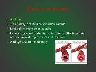 Special circumstances
• Asthma
• 1/3 of allergic rhinitis patients have asthma
• Leukotriene receptor antagonist
• Levocetrizine and desloratidine have some effects on nasal
obstruction and improves seasonal asthma
• Anti IgE and immunotherapy
 