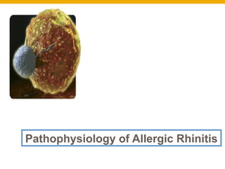 Management of Allergic Rhinitis .pptx