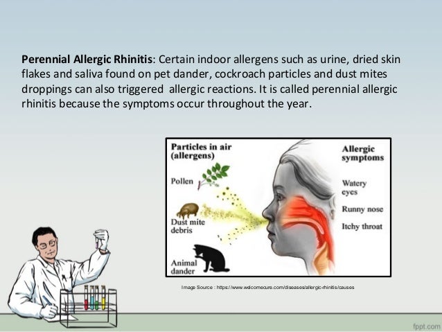 Symptoms And Treatment Of Allergic Rhinitis