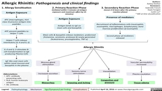 Comprehensive Overview of Allergic Rhinitis and Nasal Polyposis ...