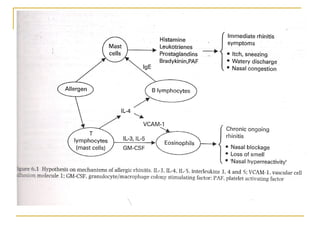 Allergic rhinitis & vasomotor rhinitis theory modified dr.bakshi-17.05.06