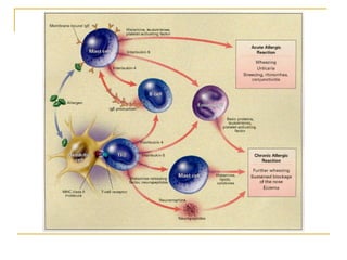 Vaso Rhinitis Allergic rhinitis & vasomotor rhinitis theory modified dr.bakshi-17.05.06