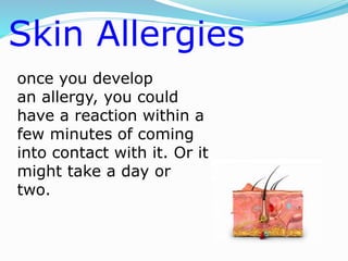 once you develop
an allergy, you could
have a reaction within a
few minutes of coming
into contact with it. Or it
might take a day or
two.
Skin Allergies
 