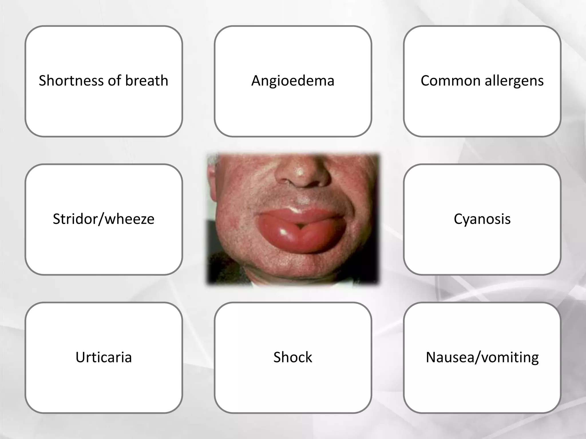 Stridor/wheeze
Nausea/vomiting
Shortness of breath
Cyanosis
ShockUrticaria
Common allergensAngioedema
 