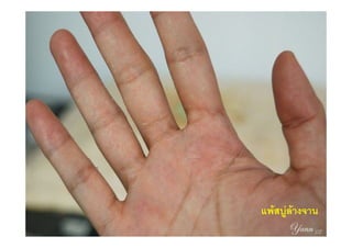 แพสบูลางจาน
 