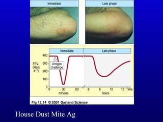 House Dust Mite Ag 