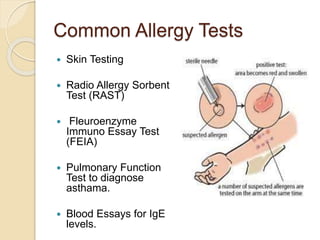 Allergy Rast Panel Allergy | PPTX