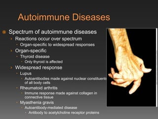 Allergy.ppt