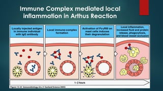 Immune Complex mediated local
inflammation in Arthus Reaction
 