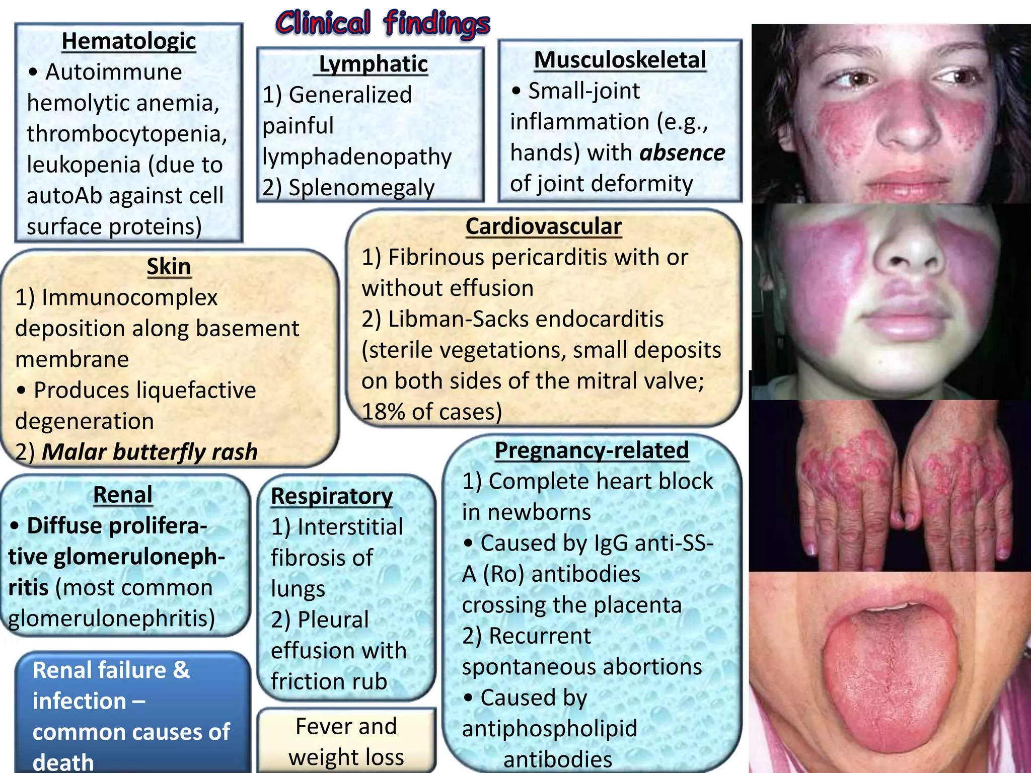 Hematologic
• Autoimmune
hemolytic anemia,
thrombocytopenia,
leukopenia (due to
autoAb against cell
surface proteins)
Lymphatic
1) Generalized
painful
lymphadenopathy
2) Splenomegaly
Musculoskeletal
• Small-joint
inflammation (e.g.,
hands) with absence
of joint deformity
Skin
1) Immunocomplex
deposition along basement
membrane
• Produces liquefactive
degeneration
2) Malar butterfly rash
Renal
• Diffuse prolifera-
tive glomeruloneph-
ritis (most common
glomerulonephritis)
Cardiovascular
1) Fibrinous pericarditis with or
without effusion
2) Libman-Sacks endocarditis
(sterile vegetations, small deposits
on both sides of the mitral valve;
18% of cases)
Respiratory
1) Interstitial
fibrosis of
lungs
2) Pleural
effusion with
friction rub
Pregnancy-related
1) Complete heart block
in newborns
• Caused by IgG anti-SS-
A (Ro) antibodies
crossing the placenta
2) Recurrent
spontaneous abortions
• Caused by
antiphospholipid
antibodies
Fever and
weight loss
Renal failure &
infection –
common causes of
death
 