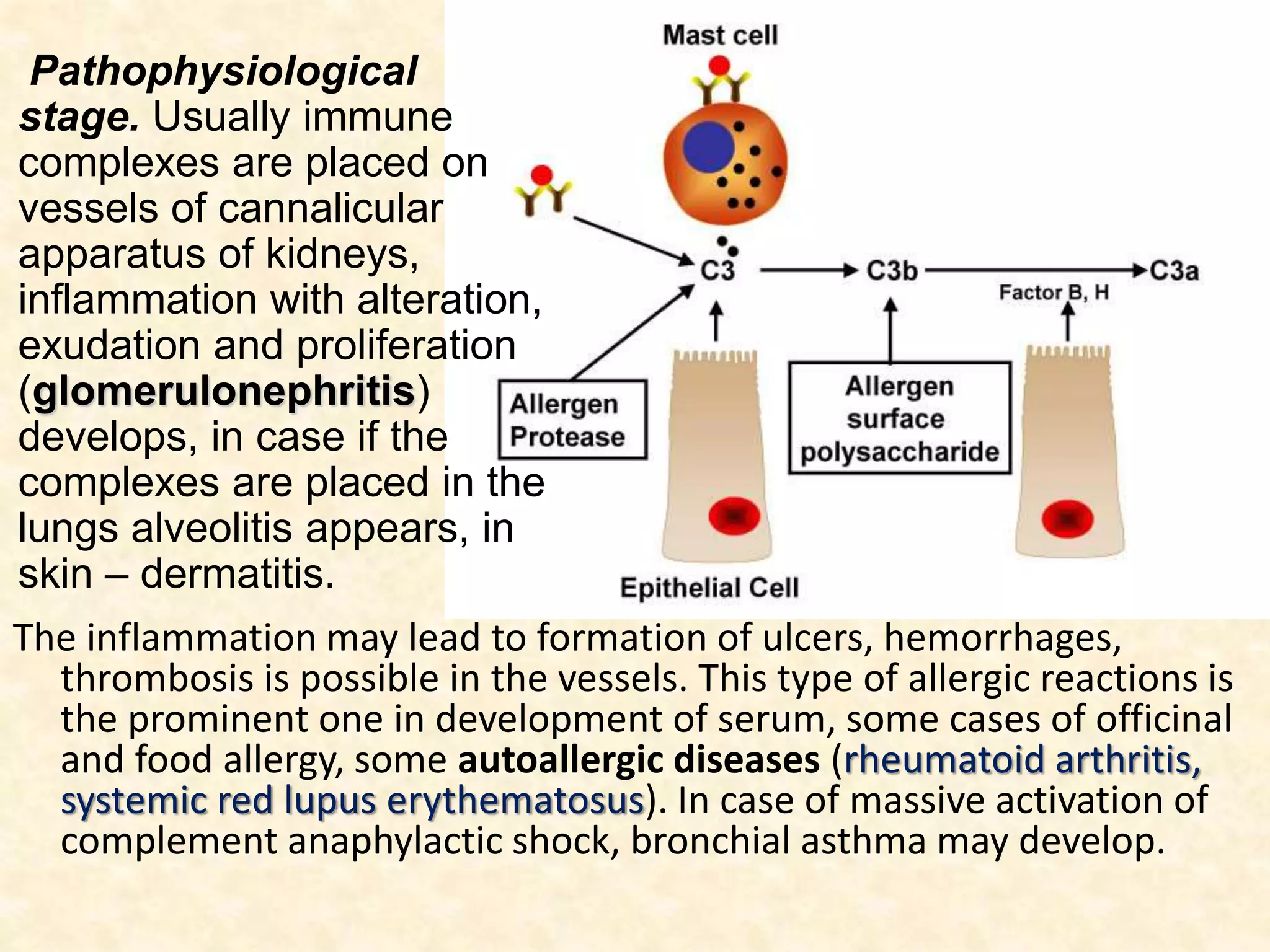 The inflammation may lead to formation of ulcers, hemorrhages,
thrombosis is possible in the vessels. This type of allergic reactions is
the prominent one in development of serum, some cases of officinal
and food allergy, some autoallergic diseases (rheumatoid arthritis,
systemic red lupus erythematosus). In case of massive activation of
complement anaphylactic shock, bronchial asthma may develop.
Pathophysiological
stage. Usually immune
complexes are placed on
vessels of cannalicular
apparatus of kidneys,
inflammation with alteration,
exudation and proliferation
(glomerulonephritis)
develops, in case if the
complexes are placed in the
lungs alveolitis appears, in
skin – dermatitis.
 