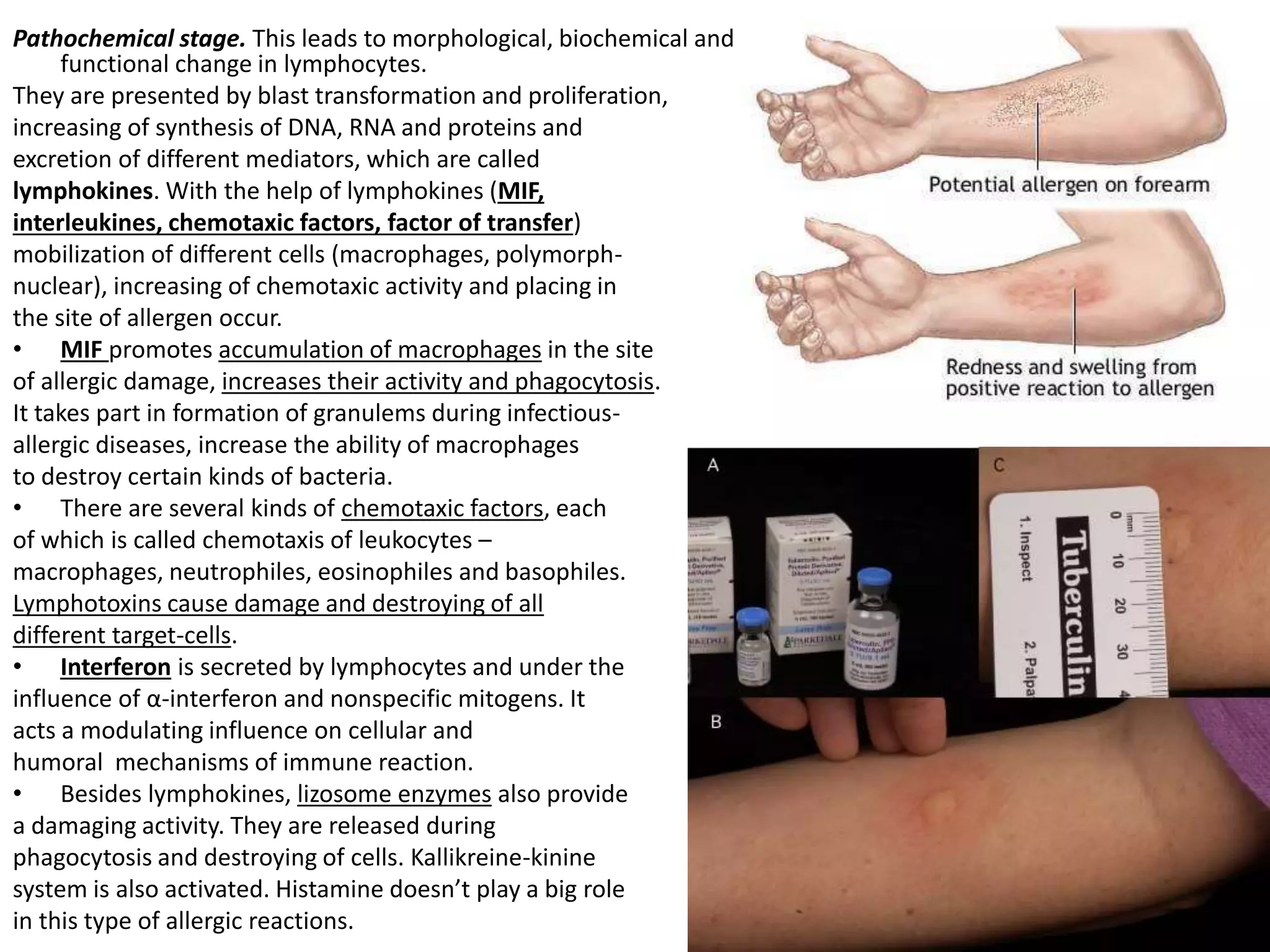 Pathochemical stage. This leads to morphological, biochemical and
functional change in lymphocytes.
They are presented by blast transformation and proliferation,
increasing of synthesis of DNA, RNA and proteins and
excretion of different mediators, which are called
lymphokines. With the help of lymphokines (MIF,
interleukines, chemotaxic factors, factor of transfer)
mobilization of different cells (macrophages, polymorph-
nuclear), increasing of chemotaxic activity and placing in
the site of allergen occur.
• MIF promotes accumulation of macrophages in the site
of allergic damage, increases their activity and phagocytosis.
It takes part in formation of granulems during infectious-
allergic diseases, increase the ability of macrophages
to destroy certain kinds of bacteria.
• There are several kinds of chemotaxic factors, each
of which is called chemotaxis of leukocytes –
macrophages, neutrophiles, eosinophiles and basophiles.
Lymphotoxins cause damage and destroying of all
different target-cells.
• Interferon is secreted by lymphocytes and under the
influence of α-interferon and nonspecific mitogens. It
acts a modulating influence on cellular and
humoral mechanisms of immune reaction.
• Besides lymphokines, lizosome enzymes also provide
a damaging activity. They are released during
phagocytosis and destroying of cells. Kallikreine-kinine
system is also activated. Histamine doesn’t play a big role
in this type of allergic reactions.
 