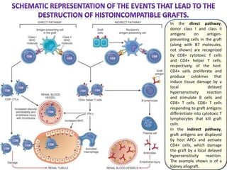 In the direct pathway,
donor class I and class II
antigens on antigen-
presenting cells in the graft
(along with B7 molecules,
not shown) are recognized
by CD8+ cytotoxic T cells
and CD4+ helper T cells,
respectively, of the host.
CD4+ cells proliferate and
produce cytokines that
induce tissue damage by a
local delayed
hypersensitivity reaction
and stimulate B cells and
CD8+ T cells. CD8+ T cells
responding to graft antigens
differentiate into cytotoxic T
lymphocytes that kill graft
cells.
In the indirect pathway,
graft antigens are displayed
by host APCs and activate
CD4+ cells, which damage
the graft by a local delayed
hypersensitivity reaction.
The example shown is of a
kidney allograft.
 