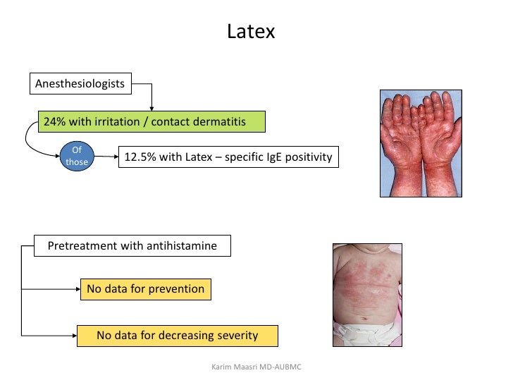 Allergy and anesthesia